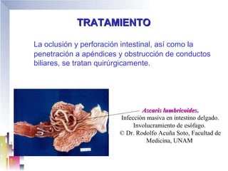 TRATAMIENTO

La oclusión y perforación intestinal, así como la
penetración a apéndices y obstrucción de conductos
biliares, se tratan quirúrgicamente.




                                Ascaris lumbricoides.
                        Infección masiva en intestino delgado.
                             Involucramiento de esófago.
                        © Dr. Rodolfo Acuña Soto, Facultad de
                                  Medicina, UNAM
 
