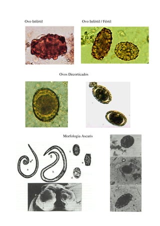 Ovo Infértil

Ovo Infértil / Fértil

Ovos Decorticados

Morfologia Ascaris

 