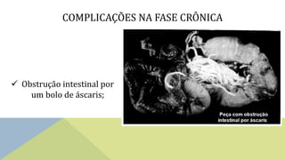 COMPLICAÇÕES NA FASE CRÔNICA
 Obstrução intestinal por
um bolo de áscaris;
 