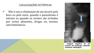 LOCALIZAÇÕES ECTÓPICAS
 Não é rara a eliminação de um áscaris pela
boca ou pelo nariz, quando o parasitismo é
intenso ou quando os vermes são irritados
por certos alimentos, drogas ou, mesmo,
anti-helmínticos.
 