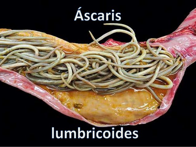ascaris-lumbricoides-2-638.jpg