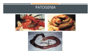 PATOGENIA
 