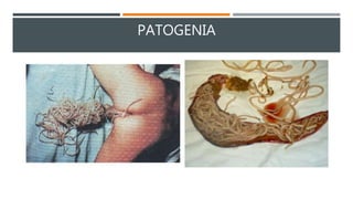 PATOGENIA
 
