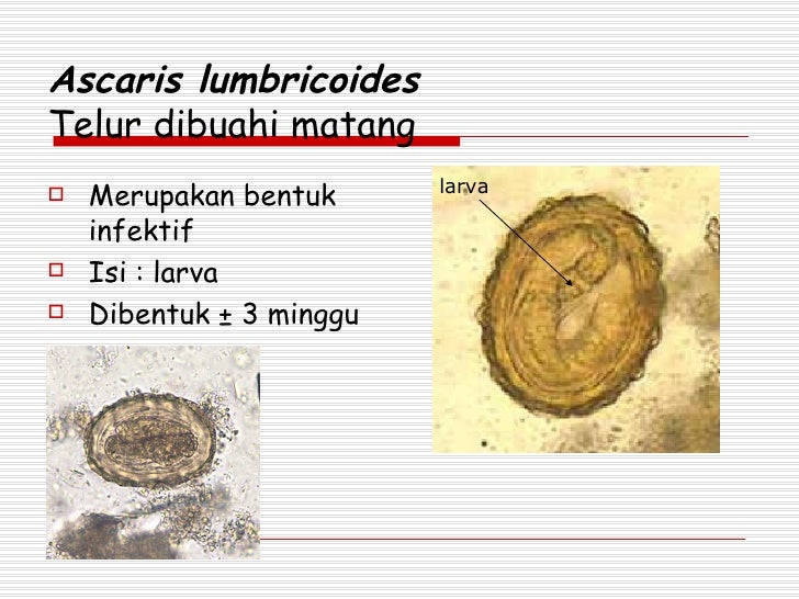 Ascaris Lumbricoides Dan Trichuris Trichiura