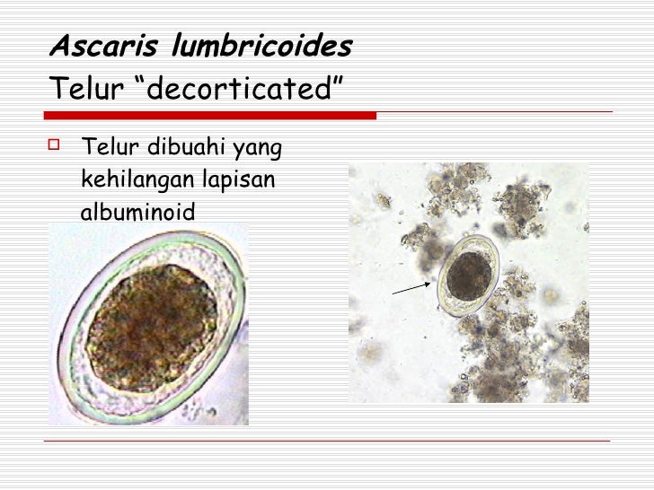 Ascaris Lumbricoides Dan Trichuris Trichiura