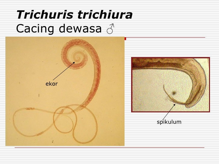  CACING  TRICHURIS TRICHIURA PDF
