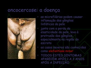oncocercose: a doença as microfilárias podem causar inflamação dos gânglios linfáticos da pele junto com a perda da elasticidade da pele, leva à protrusão dos gânglios, especialmente na região do escroto os casos severos são conhecidos como  elefantíase minor TODOS ESTES SINTOMAS APARECEM APÓS 1 A 3 ANOS APÓS A INFECÇÃO 