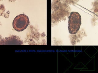                                                                                                                                                                                             Ovos fértil e infértil, respectivamente, de  Ascaris lumbricoides .   