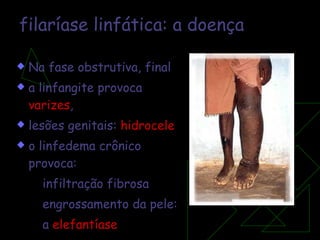 filaríase linfática:   a doença Na fase obstrutiva, final a linfangite provoca  varizes ,  lesões genitais:  hidrocele o linfedema crônico provoca: infiltração fibrosa engrossamento da pele:  a  elefantíase 