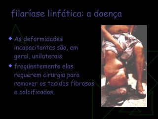 filaríase linfática:   a doença As deformidades incapacitantes são, em geral, unilaterais freqüentemente elas requerem cirurgia para remover os tecidos fibrosos e calcificados.  