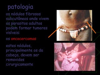 os nódulos fibrosos subcutâneos onde vivem os parasitos adultos podem formar tumores visíveis:  os  oncocercomas estes nódulos, principalmente os da cabeça, devem ser removidos cirurgicamente patologia 