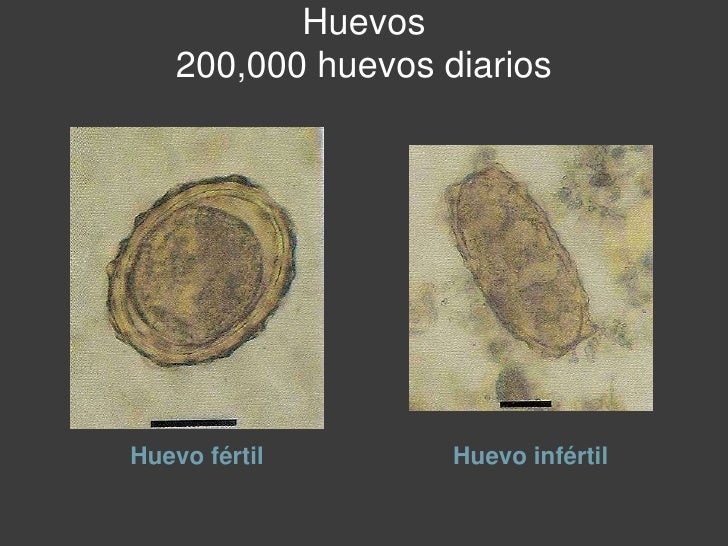 alimentos que provocan migra a ascaris lumbricoides y trichuris trichiura alimentos que provocan migra a ascaris lumbricoides y trichuris trichiura