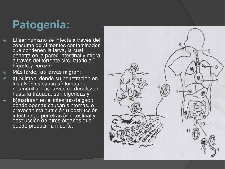 alimentos que provocan migra a ascaris lumbricoides y trichuris trichiura alimentos que provocan migra a ascaris lumbricoides y trichuris trichiura