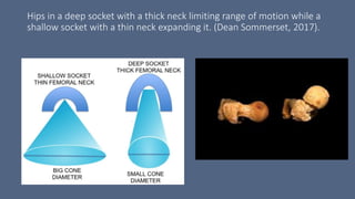 Hips in a deep socket with a thick neck limiting range of motion while a
shallow socket with a thin neck expanding it. (Dean Sommerset, 2017).
 