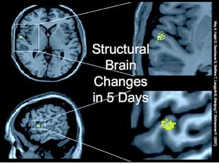 ImagescourtesyDanielAmen(1999)
 