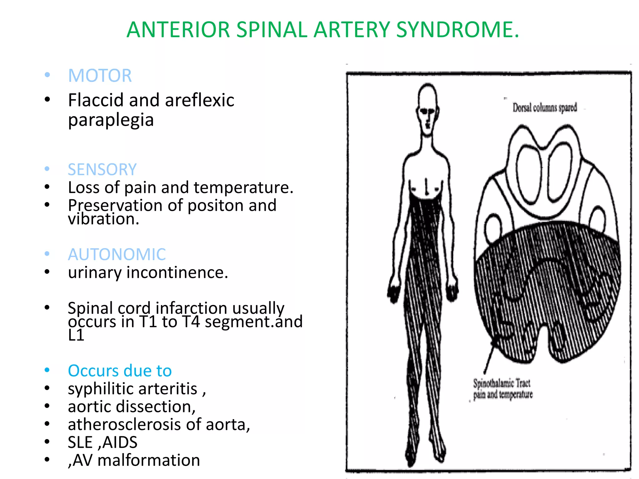 • MOTOR
• Flaccid and areflexic
paraplegia
• SENSORY
• Loss of pain and temperature.
• Preservation of positon and
vibration.
• AUTONOMIC
• urinary incontinence.
• Spinal cord infarction usually
occurs in T1 to T4 segment.and
L1
• Occurs due to
• syphilitic arteritis ,
• aortic dissection,
• atherosclerosis of aorta,
• SLE ,AIDS
• ,AV malformation
ANTERIOR SPINAL ARTERY SYNDROME.
 