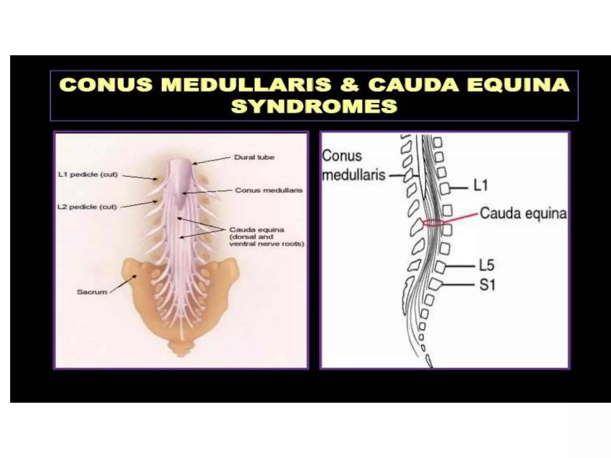 Ascending and descending tracts of spinal cord