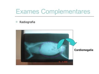 Exames Complementares Radiografia Cardiomegalia 
