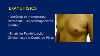EXAME FÍSICO
• Distúrbio da Homeostase
Hormonal – Hiperestrogenismo
Relativo.
• Sinais de Feminilização:
Ginecomastia e Queda de Pêlos.
 