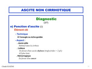 ASCITE NON CIRRHOTIQUE
Diagnostic
(3/7)
e) Ponction d'ascite (i)
Élément clé
- Technique
À l'aveugle ou écho-guidée
- Aspect :
. Jaune pâle
Habituel dans la cirrhose
. Laiteux
En faveur d'une ascite chyleuse (triglycérides > 2 g/L)
(Cf plus loin)
. Hémorragique
En faveur d'un cancer
Claude EUGÈNE 11
 