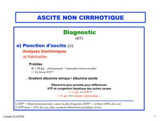 ASCITE NON CIRRHOTIQUE
Diagnostic
(4/7)
e) Ponction d'ascite (ii)
Analyses biochimiques
a) Habituelles
. Protides
Si < 25 g/L : classiquement = transsudat (versus exsudat)
=> En faveur HTP 1)
. Gradient albumine sérique / albumine ascite
Élément le plus sensible pour différencier
HTP et congestion hépatique des autres causes
> 11 g/L => HTP 2)
< 11 g/L ==> cancer, tuberculose ...
........................................................................................................................
1) HTP = Hypertension portale; cause la plus fréquente d'HTP = cirrhose (80% des cas)
2) HTP dans > 95% des cas, plus rarement dénutrition protidique sévère.
Claude EUGÈNE 12
 