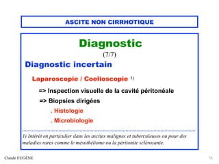 ASCITE NON CIRRHOTIQUE
Diagnostic
(7/7)
Diagnostic incertain
Laparoscopie / Coelioscopie 1)
=> Inspection visuelle de la cavité péritonéale
=> Biopsies dirigées
. Histologie
. Microbiologie
............................................................................................................................
1) Intérêt en particulier dans les ascites malignes et tuberculeuses ou pour des
maladies rares comme le mésothéliome ou la péritonite sclérosante.
Claude EUGÈNE 15
 