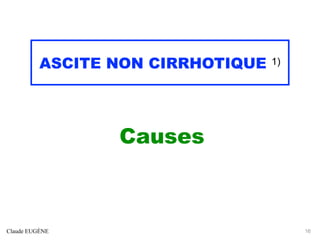 ASCITE NON CIRRHOTIQUE 1)
Causes
Claude EUGÈNE 16
 