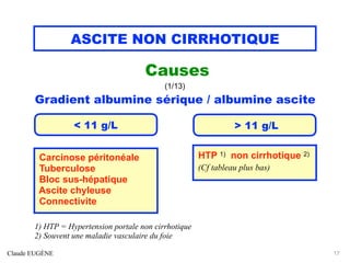 ASCITE NON CIRRHOTIQUE
Causes
(1/13)
Gradient albumine sérique / albumine ascite
Claude EUGÈNE 17
< 11 g/L > 11 g/L
Carcinose péritonéale
Tuberculose
Bloc sus-hépatique
Ascite chyleuse
Connectivite
HTP 1) non cirrhotique 2)
(Cf tableau plus bas)
1) HTP = Hypertension portale non cirrhotique
2) Souvent une maladie vasculaire du foie
 