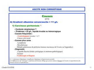 ASCITE NON CIRRHOTIQUE
Causes
(2/13)
A) Gradient albumine sérum/ascite < 11 g/L
1) Carcinose péritonéale 1)
- Contexte néoplasique ?
- Protéines > 25 g/L, liquide trouble ou hémorragique
- Causes fréquentes :
. Gynécologiques (ovaire ++) 2)
. Cancer colo-rectal
- Causes plus rares
. Lymphome
. Mésothéliome
. Maladie gélatineuse du péritoine (tumeur mucineuse de l'ovaire ou l'appendice)
- Diagnostic
. Liquide d'ascite (étude cytologique et anatomo-pathologique)
. Scanner
. Coelioscopie et biopsies
.......................................................................................................................................................................................
1) +/- métastases hépatiques, insuffisance hépatique et hypertension portale.
2) À différencier du "classique" syndrome de Desmons Meigs qui associe tumeur bénigne de l'ovaire et épanchement des
séreuses (ascite et hydrothorax)
Claude EUGÈNE 18
 