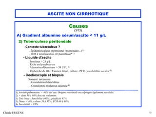 ASCITE NON CIRRHOTIQUE
Causes
(3/13)
A) Gradient albumine sérum/ascite < 11 g/L
2) Tuberculose péritonéale
- Contexte tuberculeux ?
. Épidémiologique et personnel (pulmonaire...) 1)
. IDR à la tuberculine et Quantiféron* 2)
- Liquide d'ascite
. Protéines > 25 g/L
. Riche en lymphocytes
. Adénosine désaminase > 39 UI/L 3)
. Recherche du BK: Examen direct, culture , PCR (sensibililités variées 4)
- Coelioscopie et biopsie
Souvent nécessaire
. Granulations blanchâtres
. Granulomes et nécrose caséeuse 6)
..................................................................................................................................
1) Atteinte pulmonaire: < 40% des cas. Origine intestinale ou salpingite également possibles.
2) + dans 50 à 80% des cas seulement.
3) Une étude : Sensibilité 100%, spécificité 97%
3) Direct < 6%; culture 20 à 35%; PCR 60 à 80%.
6) Sensibilité > 95%.
Claude EUGÈNE 19
 
