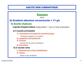 ASCITE NON CIRRHOTIQUE
Causes
(4/13)
A) Gradient albumine sérum/ascite < 11 g/L
3) Ascite chyleuse
Liquide d'aspect laiteux (triglycérides > 2 g/L et riche en protides)
a) 4 causes principales
1) Traumatisme chirurgical du canal thoracique
(Chirurgie urologique ou vasculaire)
2) Lymphome rétro-péritonéal
3) Cirrhose
(Environ 6% des ascites cirrhotiques)
4) Pancréatite
b) 2 causes rares
1) Dysplasie des canaux lymphatiques
2) Filaires
(Séjour en pays d'endémie)
Claude EUGÈNE 20
 