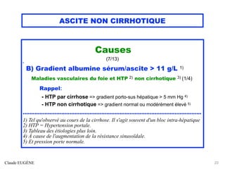 ASCITE NON CIRRHOTIQUE
Causes
(7/13)
h
B) Gradient albumine sérum/ascite > 11 g/L 1)
Maladies vasculaires du foie et HTP 2) non cirrhotique 3) (1/4)
Rappel:
- HTP par cirrhose => gradient porto-sus hépatique > 5 mm Hg 4)
- HTP non cirrhotique => gradient normal ou modérément élevé 5)
...........................................................................................................
1) Tel qu'observé au cours de la cirrhose. Il s'agit souvent d'un bloc intra-hépatique
2) HTP = Hypertension portale.
3) Tableau des étiologies plus loin.
4) À cause de l'augmentation de la résistance sinusoïdale.
5) Et pression porte normale.
Claude EUGÈNE 23
 