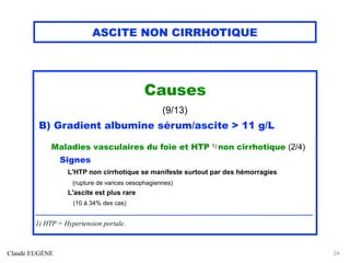 ASCITE NON CIRRHOTIQUE
Causes
(9/13)
B) Gradient albumine sérum/ascite > 11 g/L
Maladies vasculaires du foie et HTP 1) non cirrhotique (2/4)
Signes
L'HTP non cirrhotique se manifeste surtout par des hémorragies
(rupture de varices oesophagiennes)
L'ascite est plus rare
(10 à 34% des cas)
......................................................................................................................................................................
1) HTP = Hypertension portale.
Claude EUGÈNE 24
 