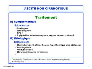 ASCITE NON CIRRHOTIQUE
Traitement
A) Symptomatique
Selon les cas
- Diurétiques
- Bêta-bloqueurs
- TIPS 1)
- Triglycérides à chaînes moyenne, régime hyper-protidique 2)
B) Étiologique
Selon les cas
- Chimiothérapie +/- chimiothérapie hyperthermique intra-péritonéale
- Anticoagulants
- Anti-tuberculeux
- Chirurgie (péricardite constrictive)
- ...
.............................................................................................................................................................................
1) Transjugular Intrahepatic Porto-Systemic Shunt (hypertension portale)
2) Ascite chyleuse.
Claude EUGÈNE 31
 