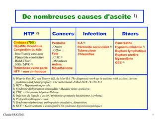 De nombreuses causes d'ascite 1)
Claude EUGÈNE 4
HTP 2) Cancers Infection Divers
Cirrhose (75%)
Hépatite alcoolique
Congestion du foie
. Insuffisance cardiaque
. Péricardite constrictive
. Budd-Chiari
. SOS / MVO 3)
Thrombose veine porte
HTP 1) non cirrhotique
Péritoine
. Ovaire
. Côlon ...
Foie
. CHC 4)
. Métastases
Autres
Mésothéliome
ILA 5)
Péritonite secondaire 6)
Tuberculose
Chlamidiae
Pancréatite
Hypoalbuminémie 7)
Rupture lymphatique
Rupture uretère
Myxoedème
GEE 8)
1) D'après Oey RC, van Buuren HR, de Man RA. The diagnostic work-up in patients with ascites: current
guidelines and future propects. The Netherlands J Med 2016;74:330-335
2) HTP = Hypertension portale.
3) Syndrome d'obstruction sinusoïdale / Maladie veino-occlusive.
4) CHC = Carcinome hépatocellulaire.
5) Infection du liquide d'ascite / péritonite spontanée bactérienne (cirrhose).
6) Perforation d'organe creux.
7) Syndrome néphrotique, entéropathie exsudative, dénutrition.
8) GEE = Gastroentérite à éosinophiles (et syndrome hyperéosinophilique).
 