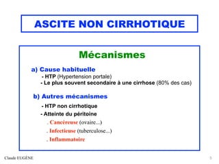 ASCITE NON CIRRHOTIQUE
Mécanismes
a) Cause habituelle
- HTP (Hypertension portale)
- Le plus souvent secondaire à une cirrhose (80% des cas)
b) Autres mécanismes
- HTP non cirrhotique
- Atteinte du péritoine
. Cancéreuse (ovaire...)
. Infectieuse (tuberculose...)
. Inflammatoire
Claude EUGÈNE 5
 