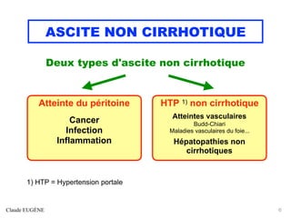 ASCITE NON CIRRHOTIQUE
Deux types d'ascite non cirrhotique
1) HTP = Hypertension portale
Claude EUGÈNE 6
Atteinte du péritoine
Cancer
Infection
Inflammation
HTP 1) non cirrhotique
Atteintes vasculaires
Budd-Chiari
Maladies vasculaires du foie...
Hépatopathies non
cirrhotiques
 