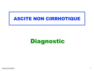 ASCITE NON CIRRHOTIQUE
Diagnostic
Claude EUGÈNE 8
 