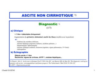 ASCITE NON CIRRHOTIQUE 1)
Diagnostic 1)
(1/7)
a) Clinique
> 1 litre = détectable cliniquement
Augmentation du périmètre abdominal; matité des flancs (mobile avec la position)
+/-
. Oedèmes des membres inférieurs
. Atteinte hépatique (angiomes stellaires, érythème palmaire...)
. Hépatomégalie, Splénomégalie
. Atteinte cardiaque (oedèmes, distension jugulaire, signes pulmonaires, 3ème bruit)
. Adénopathies
b) Échographie
Détecte ascite < 1 litre
Recherche: signes de cirrhose, d'HTP 2), nodules hépatiques...
................................................................................................................................................
1) D'après: Alric L. Ascite non cirrhotique Post'U 2016, Oey RC, van Buuren HR, de Man RA. The diagnostic work-up in
patients with ascites: currentguidelines and future propects. The Netherlands J Med 2016;74:330-335.
2) HTP = Hypertension portale
Claude EUGÈNE 9
 