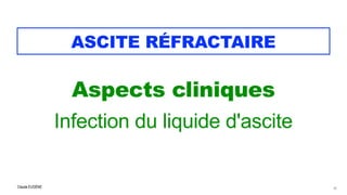Claude EUGÈNE
ASCITE RÉFRACTAIRE
Aspects cliniques


Infection du liquide d'ascite


14
 