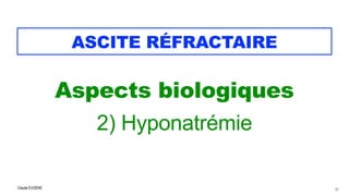 Claude EUGÈNE
ASCITE RÉFRACTAIRE
Aspects biologiques


2) Hyponatrémie


20
 