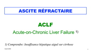 Claude EUGÈNE
ASCITE RÉFRACTAIRE
ACLF


Acute-on-Chronic Liver Failure 1)


1) Comprendre: Insuffisance hépatique aiguë sur cirrhose
29
 