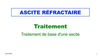 Claude EUGÈNE
ASCITE RÉFRACTAIRE
Traitement

Traitement de base d'une ascite
44
 