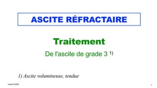 Claude EUGÈNE
ASCITE RÉFRACTAIRE
Traitement

De l'ascite de grade 3 1)


1) Ascite volumineuse, tendue
50
 