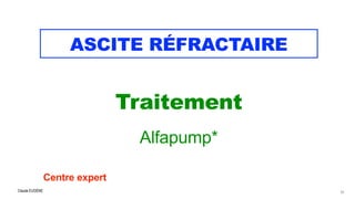 Claude EUGÈNE
ASCITE RÉFRACTAIRE
Traitement


Alfapump*


Centre expert


61
 