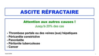 Claude EUGÈNE
ASCITE RÉFRACTAIRE
Attention aux autres causes !


Jusqu'à 20% des cas


- Thrombose portale ou des veines (sus) hépatiques


- Péricardite constrictive


- Pancréatite


- Péritonite tuberculeuse


- Cancer


9
 
