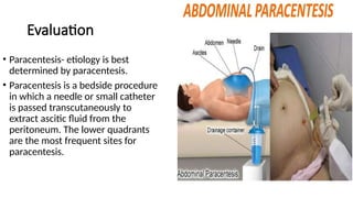 Transcutaneously Ascites.pptx ayurveda is life . health yoga | PPTX