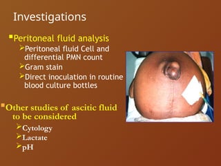 Ascites Sampling ASCITIS APPROACH AND IT'S MANANGENT WITH CLASSIFICATION | PPTX