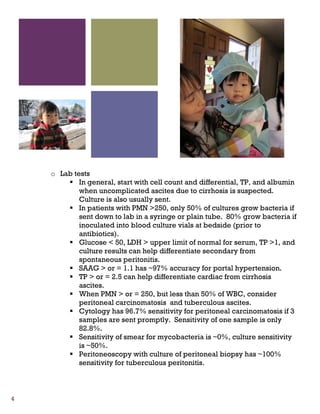 4
o Lab tests
In general, start with cell count and differential, TP, and albumin
when uncomplicated ascites due to cirrhosis is suspected.
Culture is also usually sent.
In patients with PMN >250, only 50% of cultures grow bacteria if
sent down to lab in a syringe or plain tube. 80% grow bacteria if
inoculated into blood culture vials at bedside (prior to
antibiotics).
Glucose < 50, LDH > upper limit of normal for serum, TP >1, and
culture results can help differentiate secondary from
spontaneous peritonitis.
SAAG > or = 1.1 has ~97% accuracy for portal hypertension.
TP > or = 2.5 can help differentiate cardiac from cirrhosis
ascites.
When PMN > or = 250, but less than 50% of WBC, consider
peritoneal carcinomatosis and tuberculous ascites.
Cytology has 96.7% sensitivity for peritoneal carcinomatosis if 3
samples are sent promptly. Sensitivity of one sample is only
82.8%.
Sensitivity of smear for mycobacteria is ~0%, culture sensitivity
is ~50%.
Peritoneoscopy with culture of peritoneal biopsy has ~100%
sensitivity for tuberculous peritonitis.
 