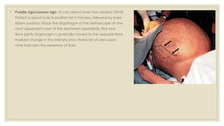 Normal Puddle Sign Ascites-Unveiling-the-Fluid-Challenge.pptx